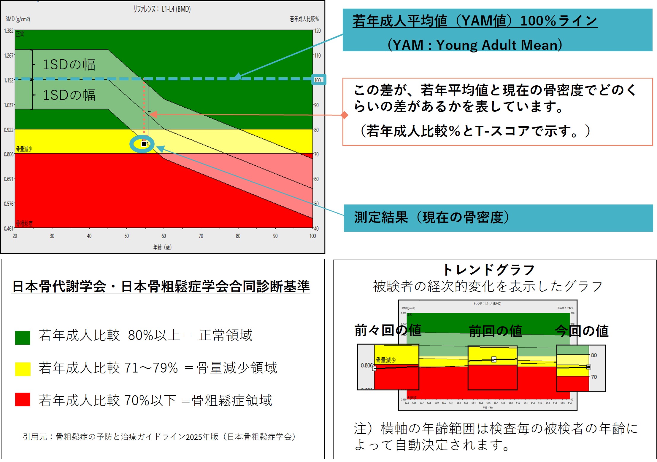 Technical Tips_term02.jpg